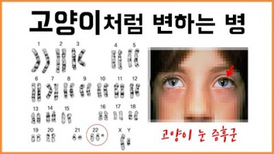 염색체에 이상이 생기면...?! - 염색체 돌연변이